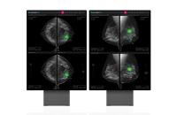 Lunit gets FDA approval for AI cancer diagnosis solution 