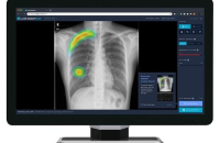 Lunit selected as contractor for building medical AI platform in Singapore 